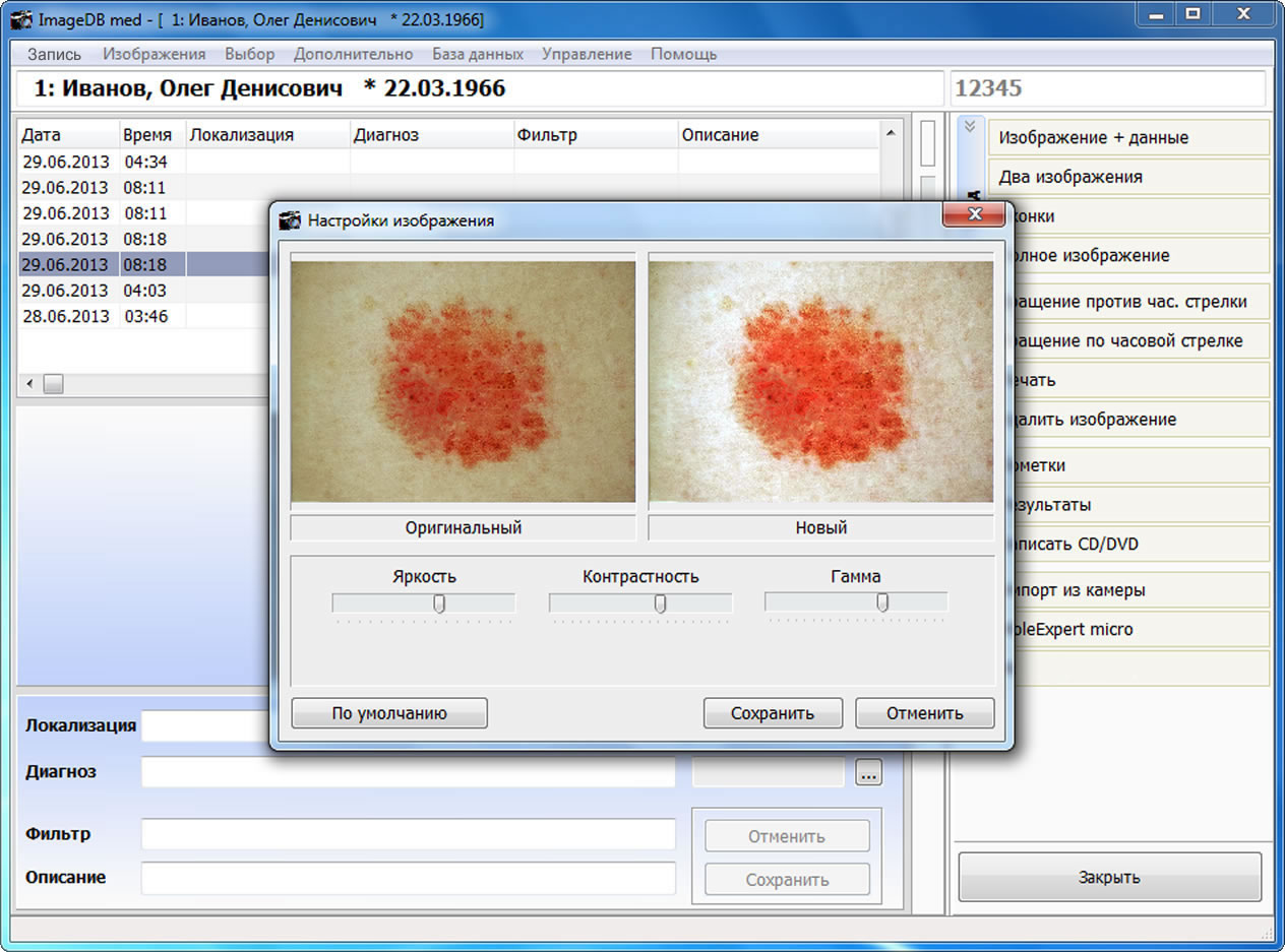 MoleExpert micro:    Image DB med