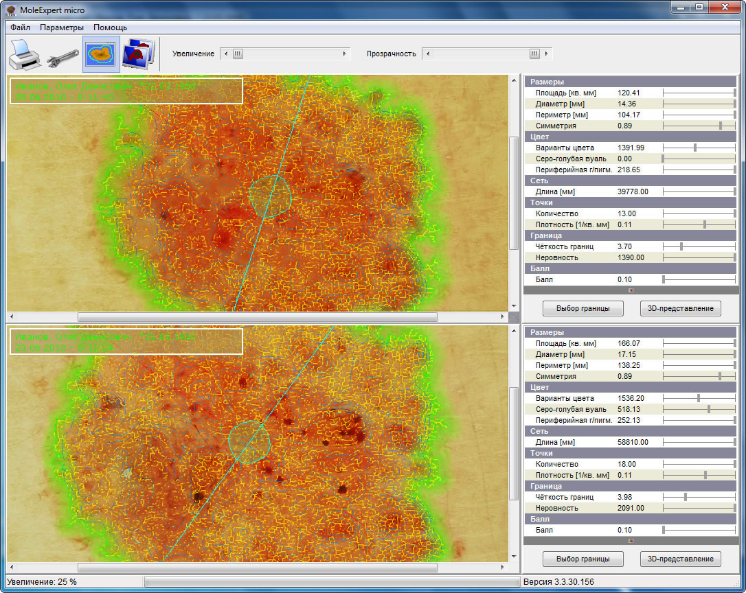 MoleExpert micro:     